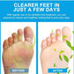 Sumifun – Foot Anti-Bacterial Cream